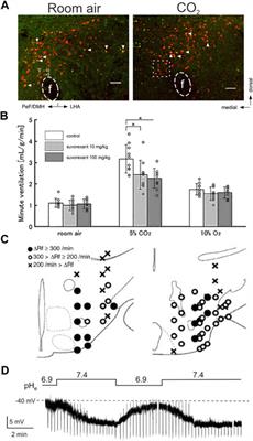 Criteria for central respiratory chemoreceptors: experimental evidence supporting current candidate cell groups